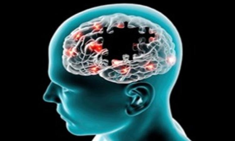 Maspero - Un nouvel essai clinique a révélé des résultats prometteurs pour un médicament pionnier spécialement conçu pour réduire l'inflamma